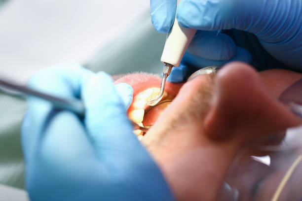 Best Urgent Dental Care for Toothache in Boonville, IN