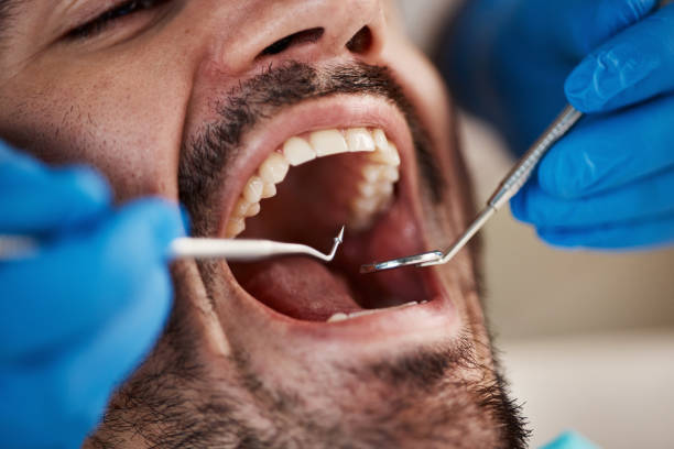 Best Holiday Emergency Dentist in Boonville, IN